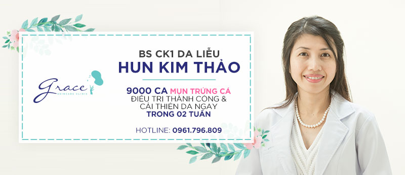 Điều trị mụn trứng cá, điều trị mụn ẩn dứt điểm cùng bác sĩ da liễu Hun Kim Thảo