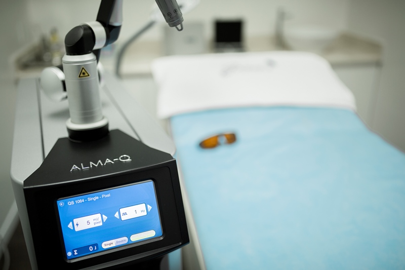 Điều trị giãn mao mạch với laser Alma Q