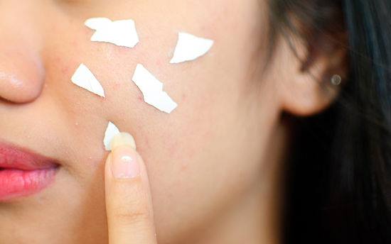 cheap microneedling near me