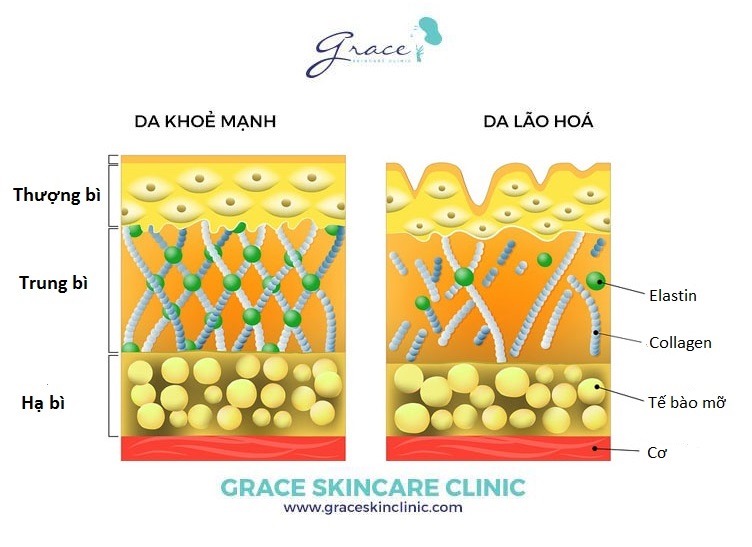 Collagen là gì vầ cách cải thiện làn da với collagen