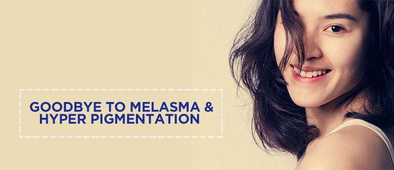 Melasma and Pigmentation Disorders Treatment