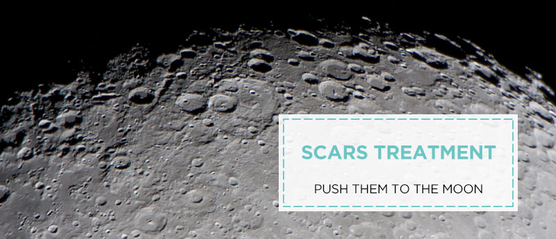 Scar Treatment Push Them To The Moon