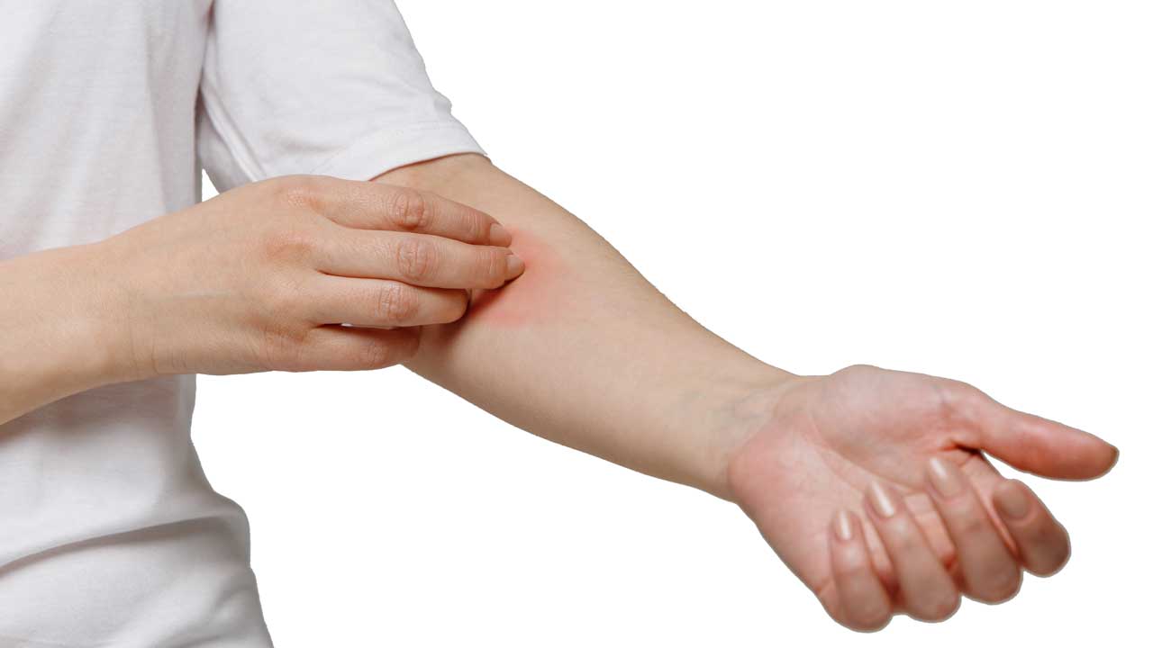 Điều trị da nhạy cảm
