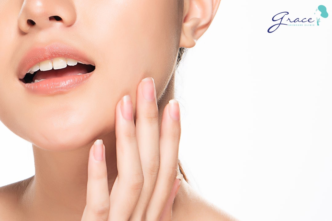 Da bị tăng sắc tố sau lăn kim, laser, peel da có trị được không? - Grace Skincare Clinic