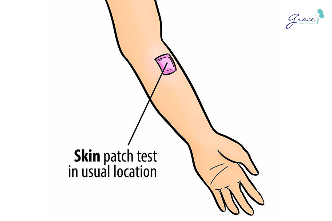 patch test tìm ra triệu chứng viêm da cơ địa