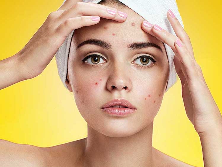 Combination Skin Treatment In Grace Skincare Clinic