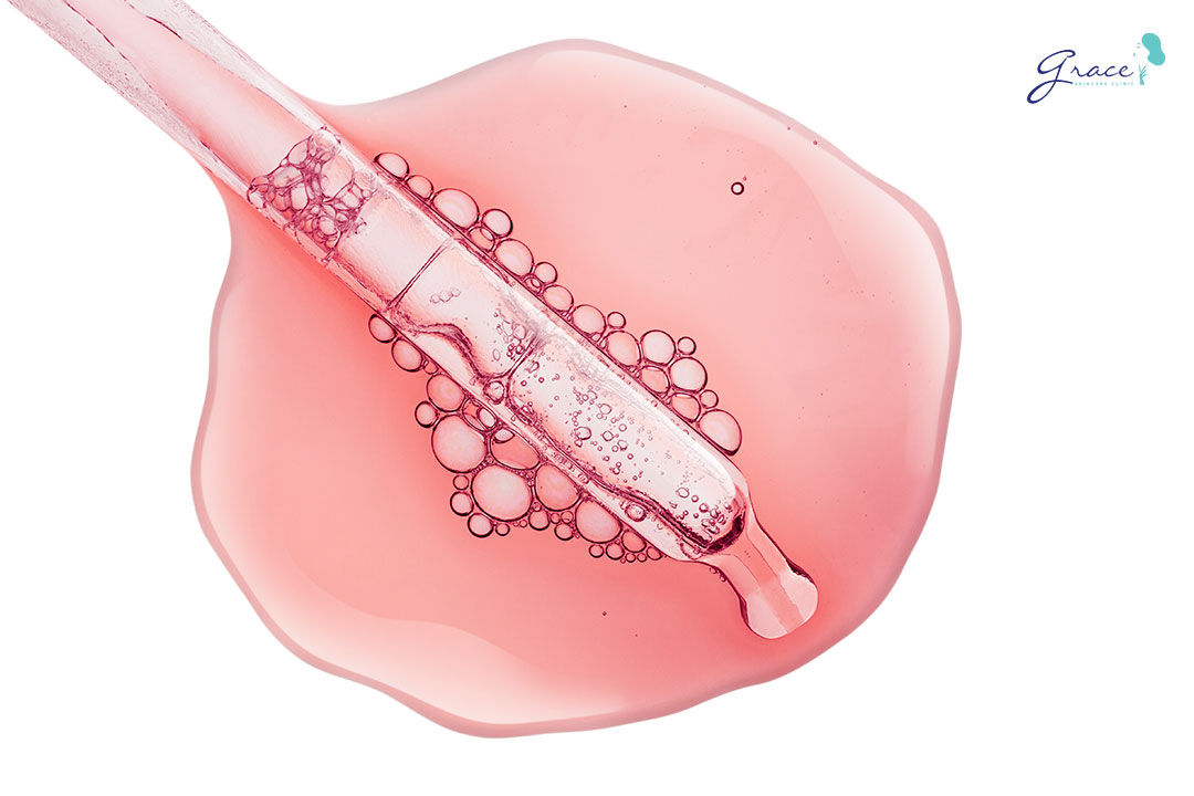 các loại retinoids trị mụn