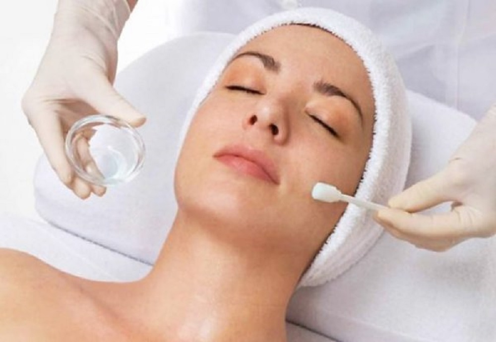 light chemical peel