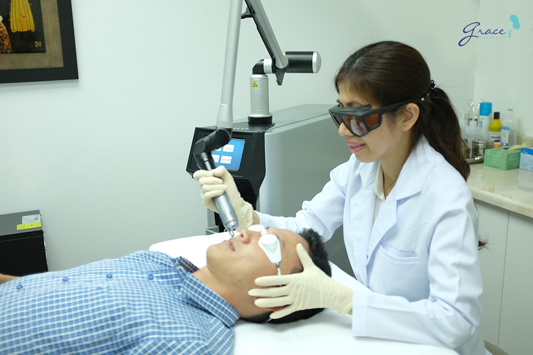 trị tàn nhang bằng laser