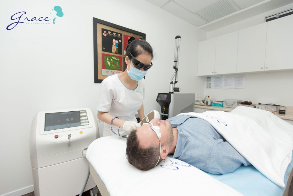 Tại sao nên chọn triệt lông Dye-PL
