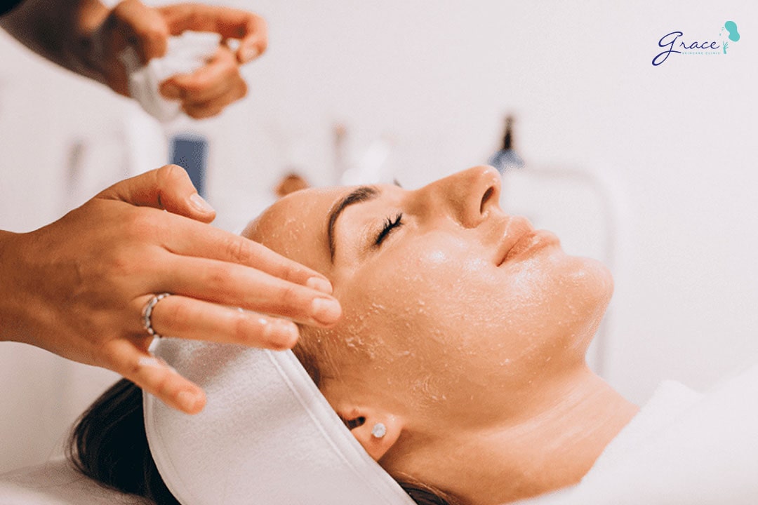 chemical peel steps at clinic