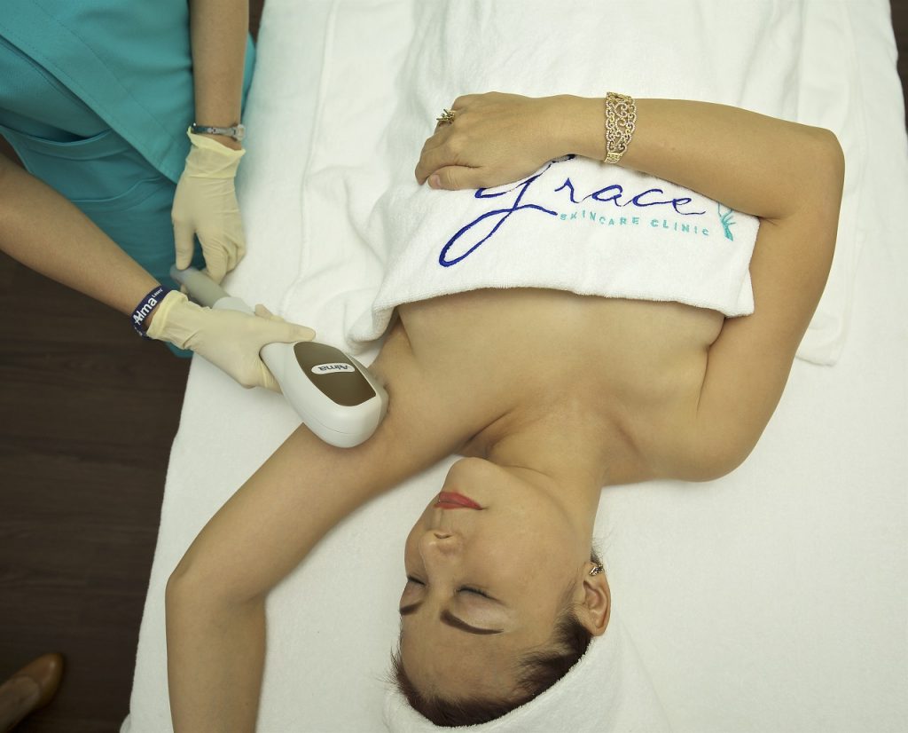 Dye-PL hair removal at Grace Skincare Clinic performed by trained nurse