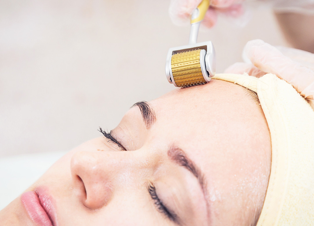 PRP Microneedling for Skin Rejuvenation at Grace Skincare Clinic