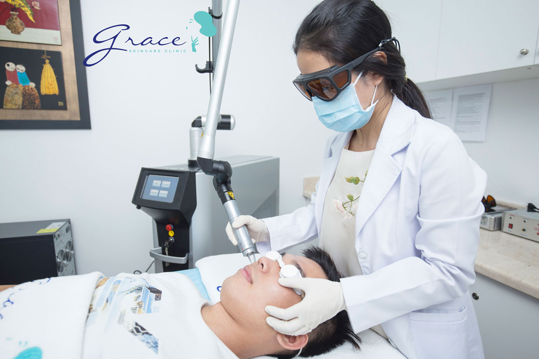 Điều trị giãn mao mạch mặt với bác sĩ da liễu tại Grace Skincare Clinic