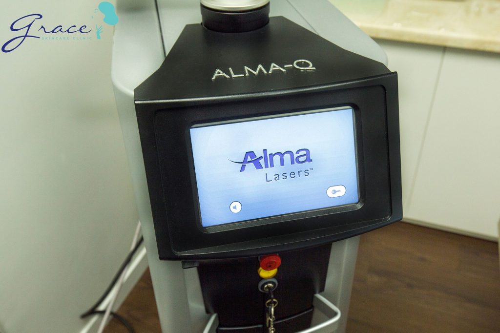 Laser Alma-Q là một trong những thiết bị xóa xăm hiệu