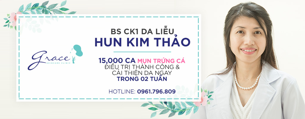 Điều trị mụn ở người lớn