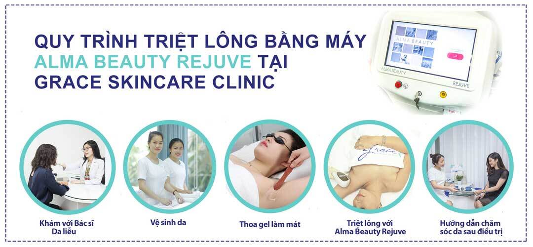 công nghệ triệt lông mặt alma beauty rejuve tại grace skincare clinic