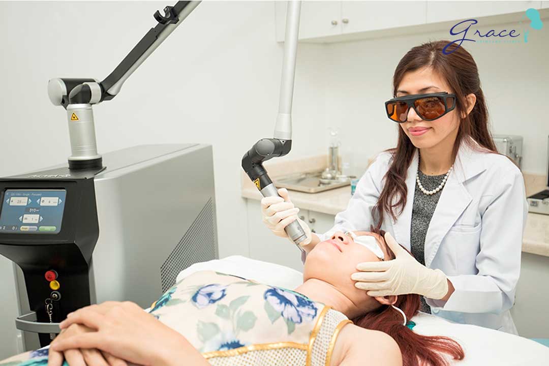 bác sĩ da liễu điều trị thâm mụn bằng laser