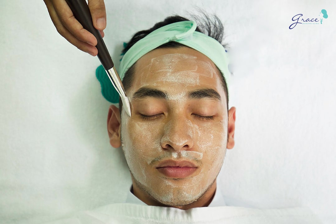 cách trị mụn thâm cho nam giới băng peel da