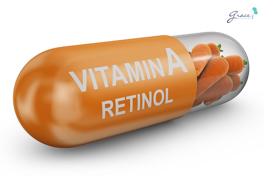 trị mụn cám bằng retinol và vitamin a