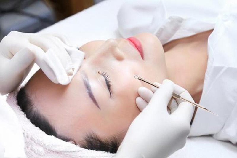 Tại sao cần điều trị mụn đúng cách?