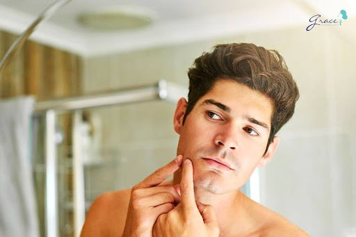 Một số lời khuyên về cách trị mụn ở tuổi dậy thì nam từ bác sĩ da liễu