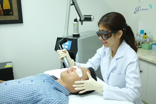Cách làm mờ vết thâm, trị mụn thâm cho nam giới hiệu quả bằng Laser Toning – trị thâm mụn bằng laser.