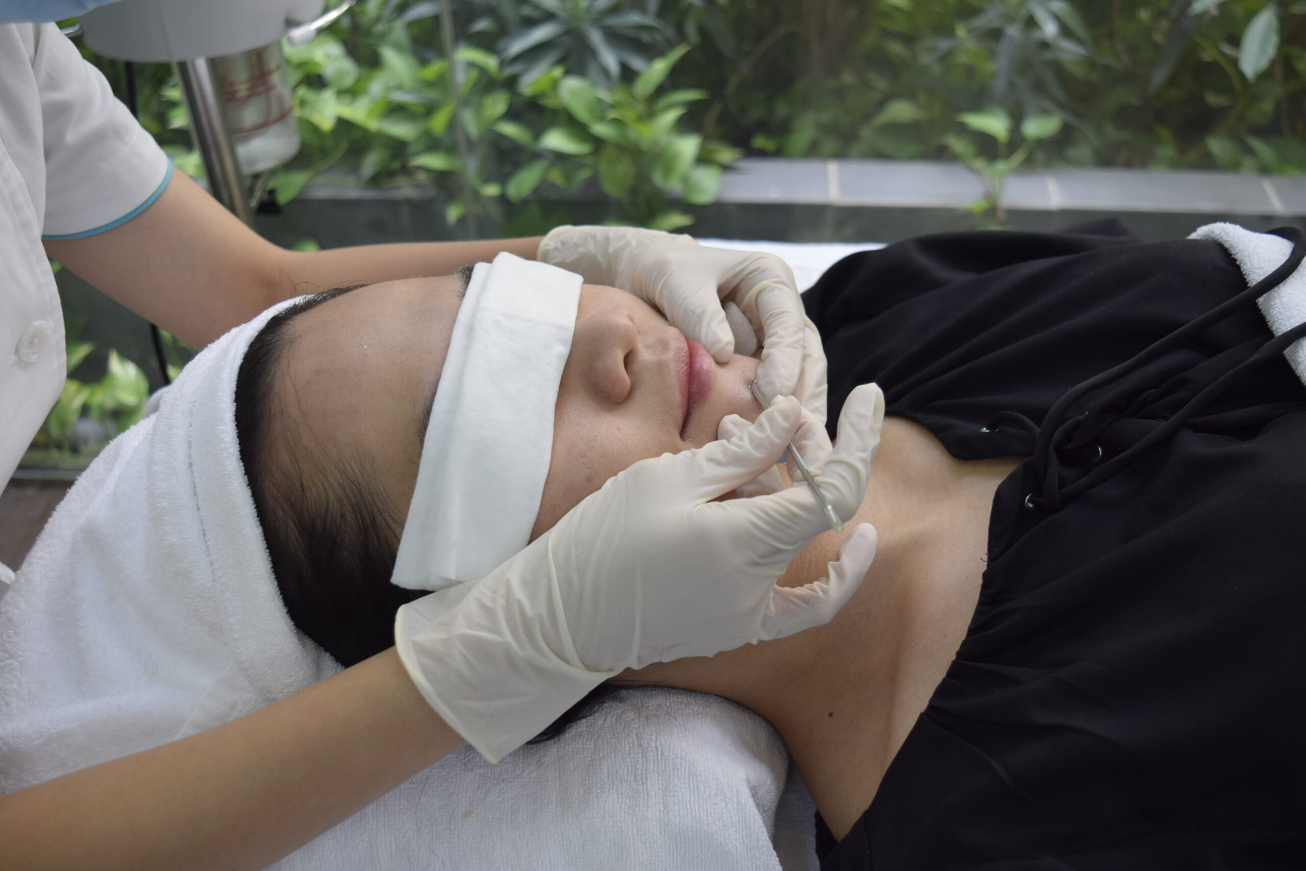Trước khi bắt đầu việc lấy mụn, nhận biết liệu mụn đã “đủ chín” để lấy nhân được hay chưa rất quan trọng